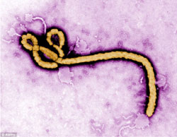 Ebola under microscope