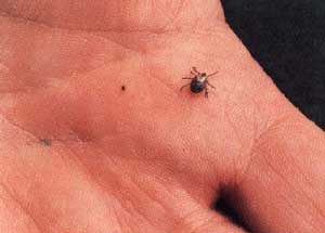 American Dog Tick and Deer Tick nymph